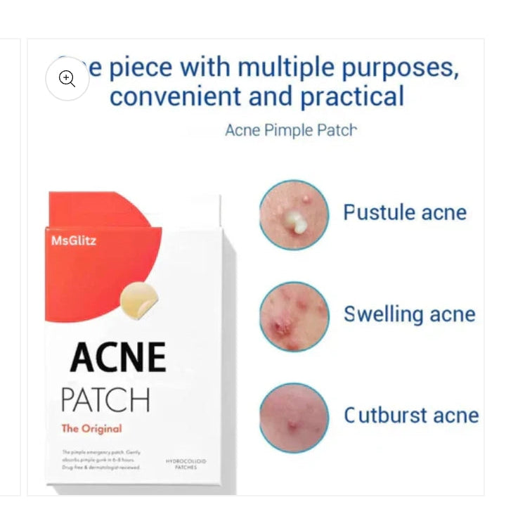 Acne patch