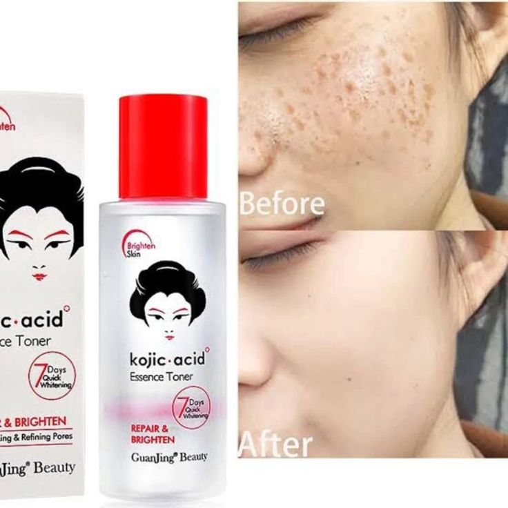 Kojic face wash,toner and face serum combo.